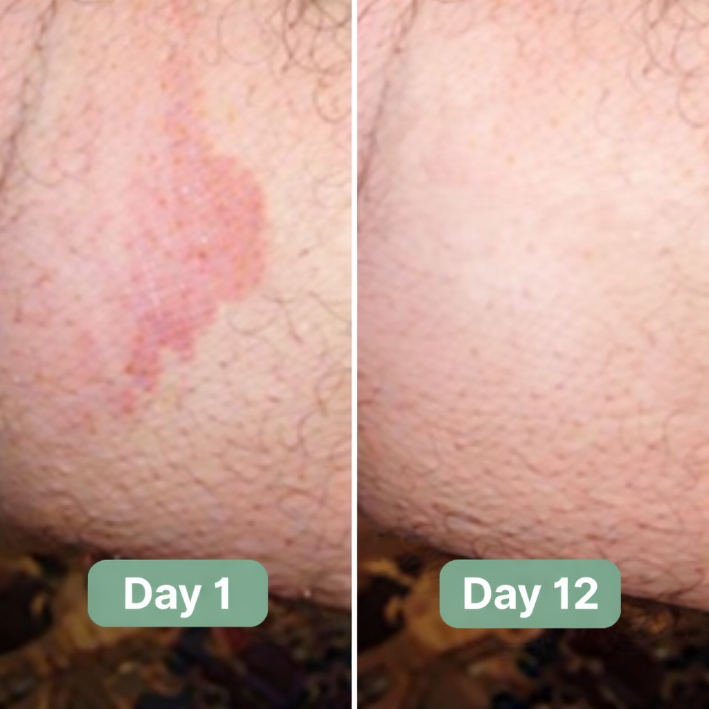 Solvuxe Antifungal Soap®